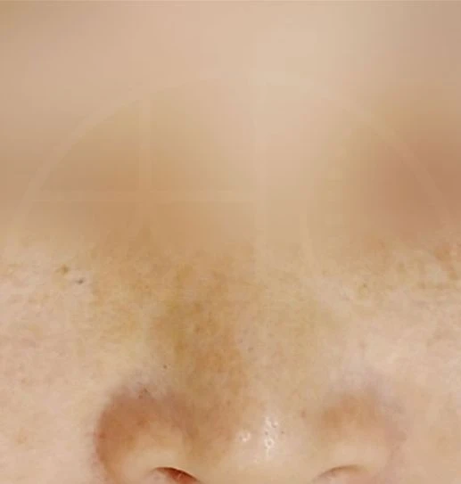 before_image