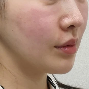 before_image