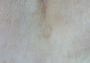 before_image