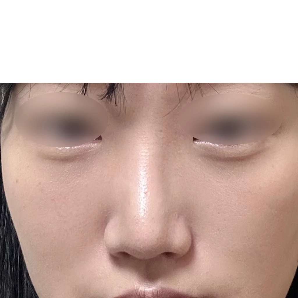 before_image