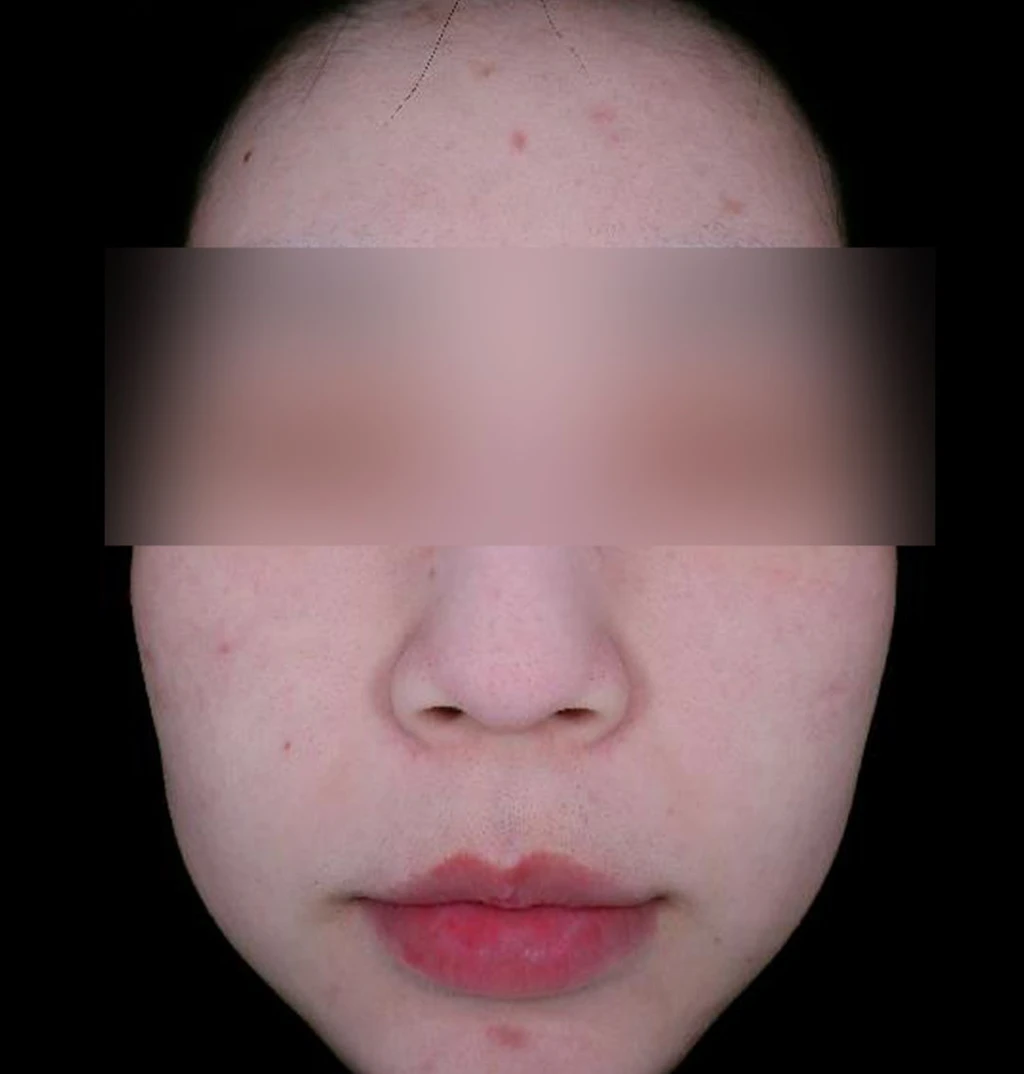 before_image