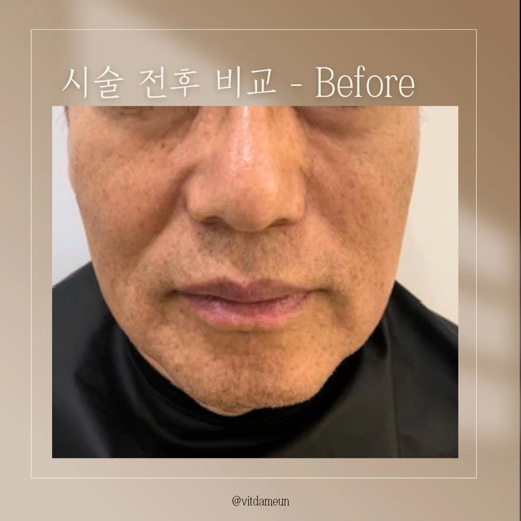 before_image