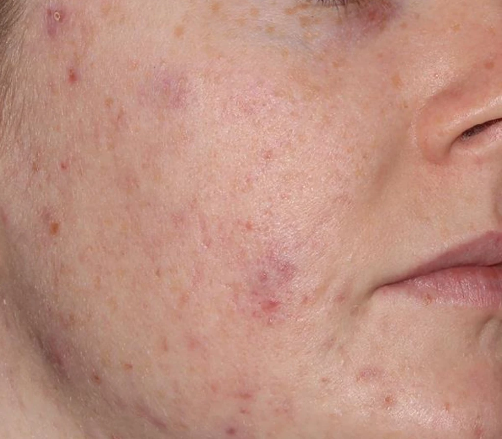 before_image