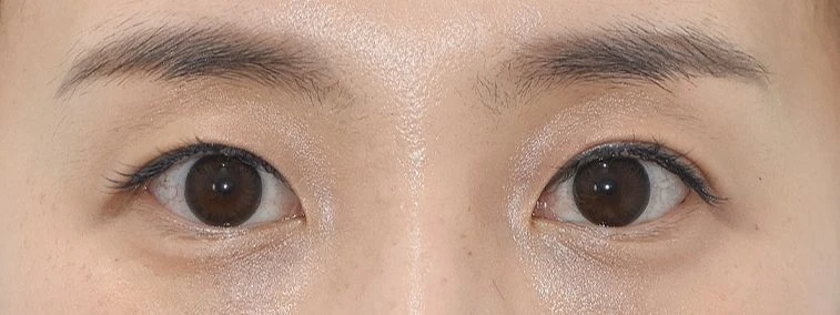 before_image