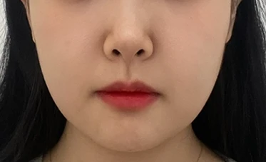 before_image