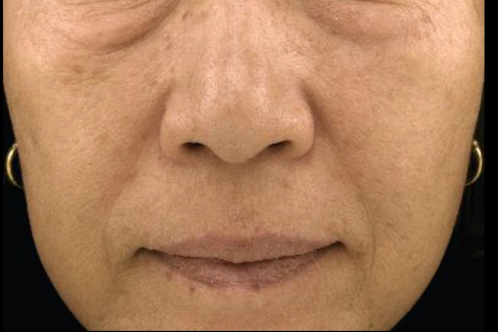 before_image