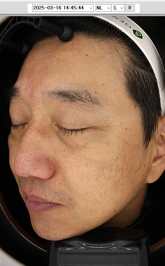 before_image
