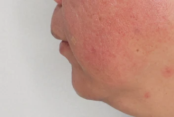 before_image