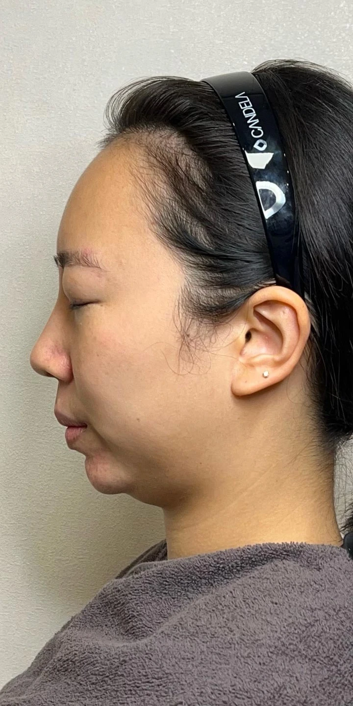 before_image