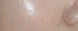 before_image