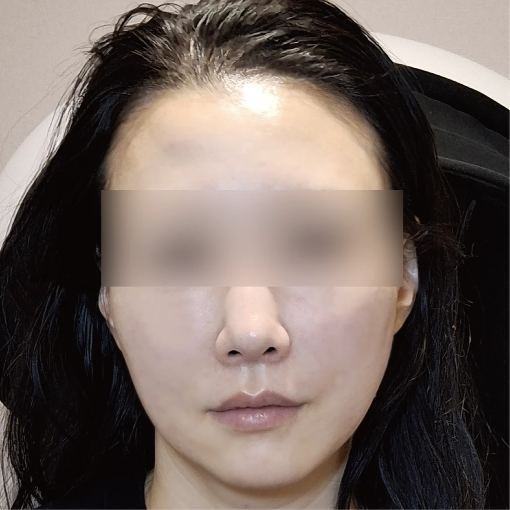 before_image