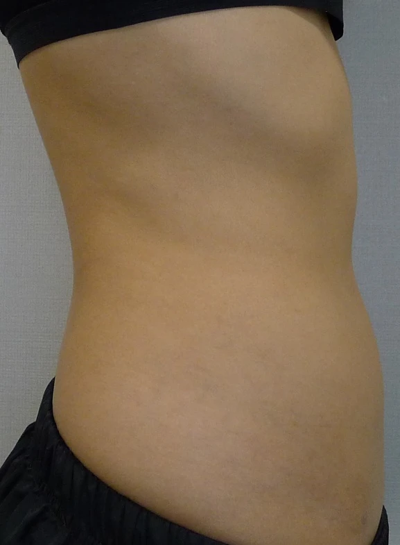 before_image