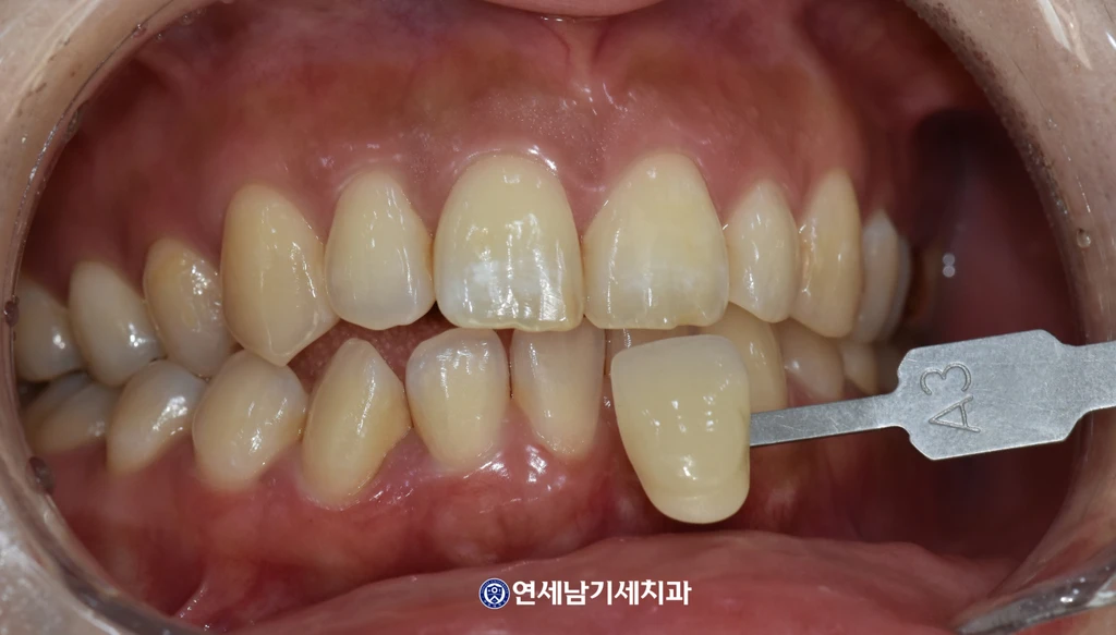before_image