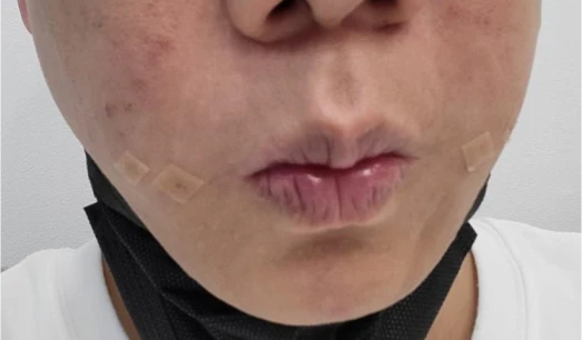 before_image