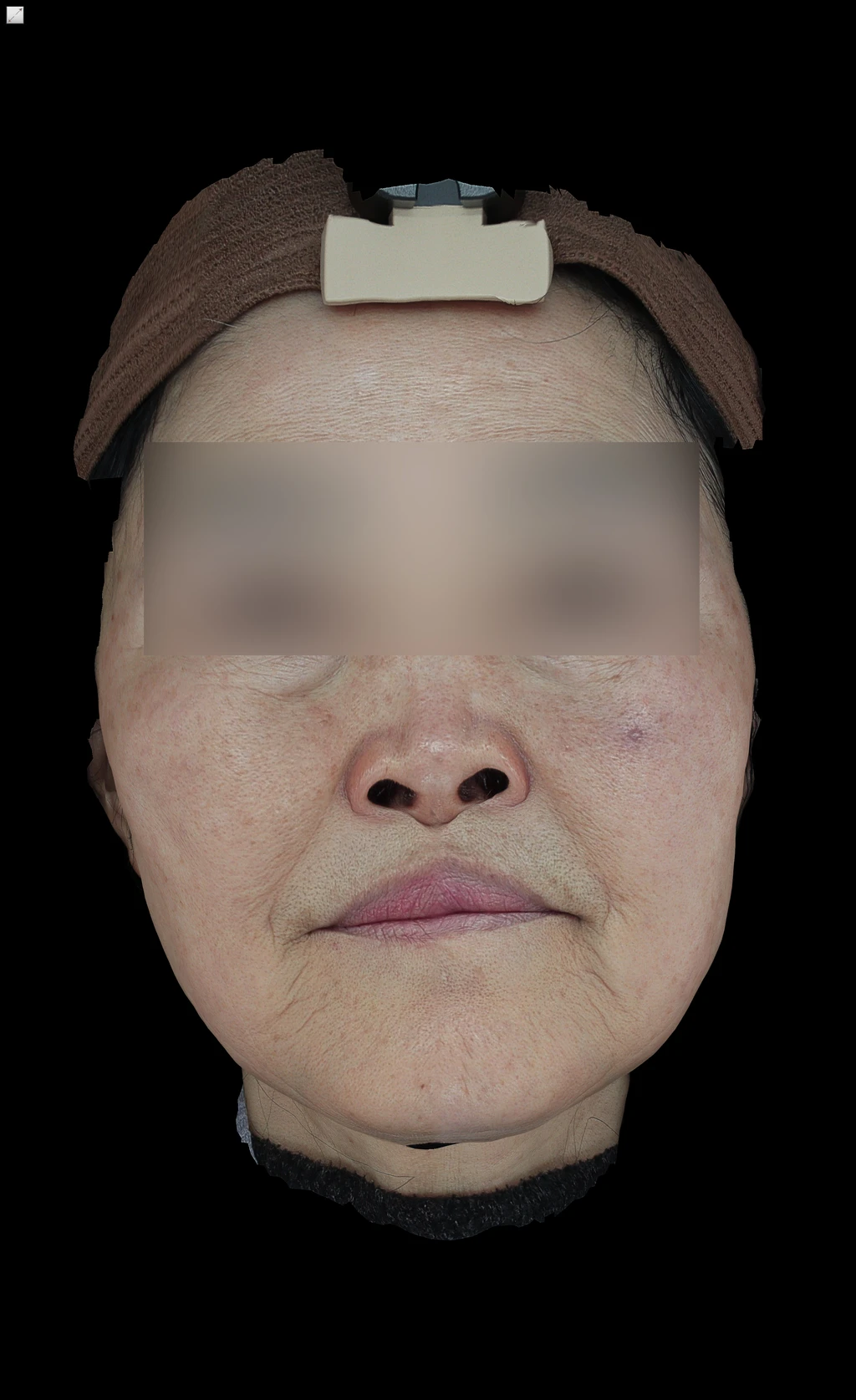 before_image