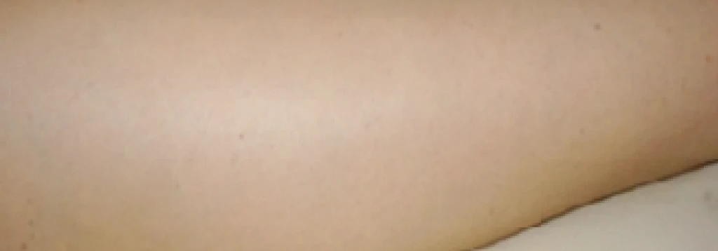 before_image