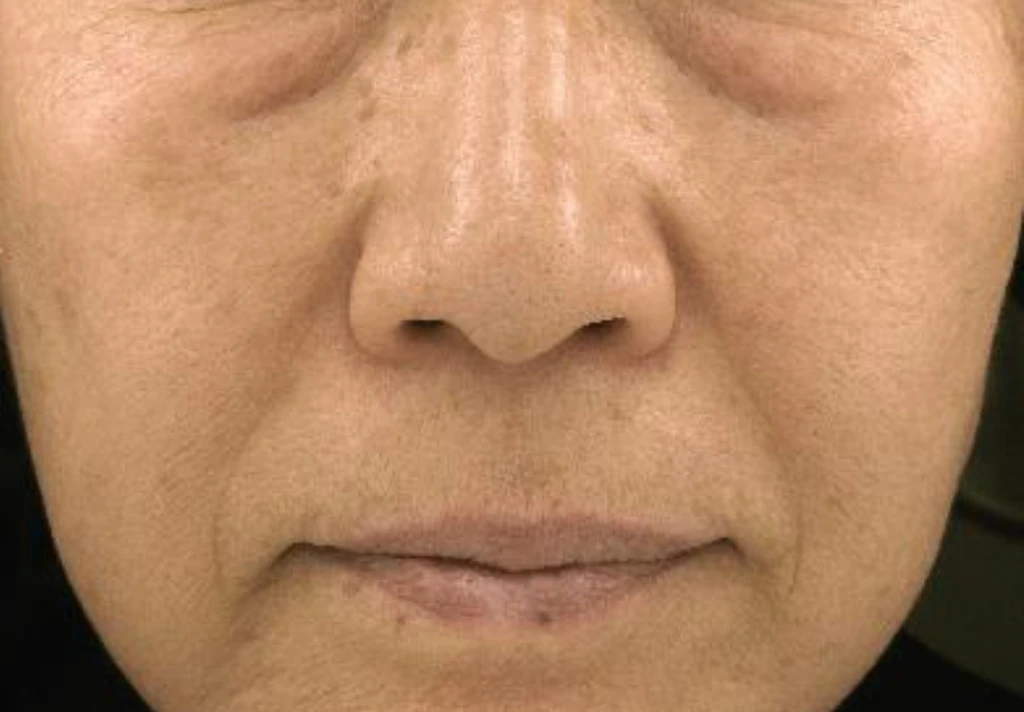 before_image