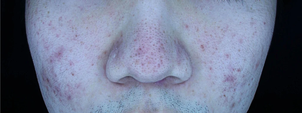 before_image