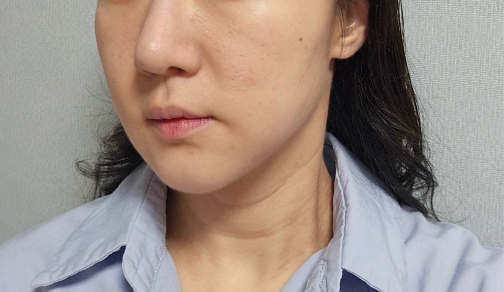 before_image