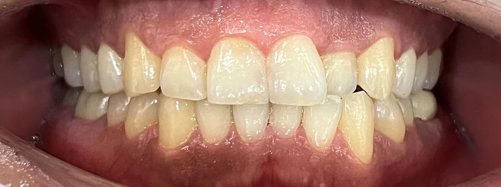 before_image