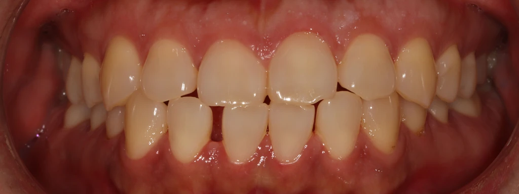 before_image