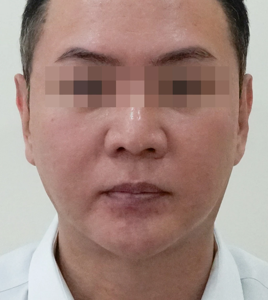 before_image