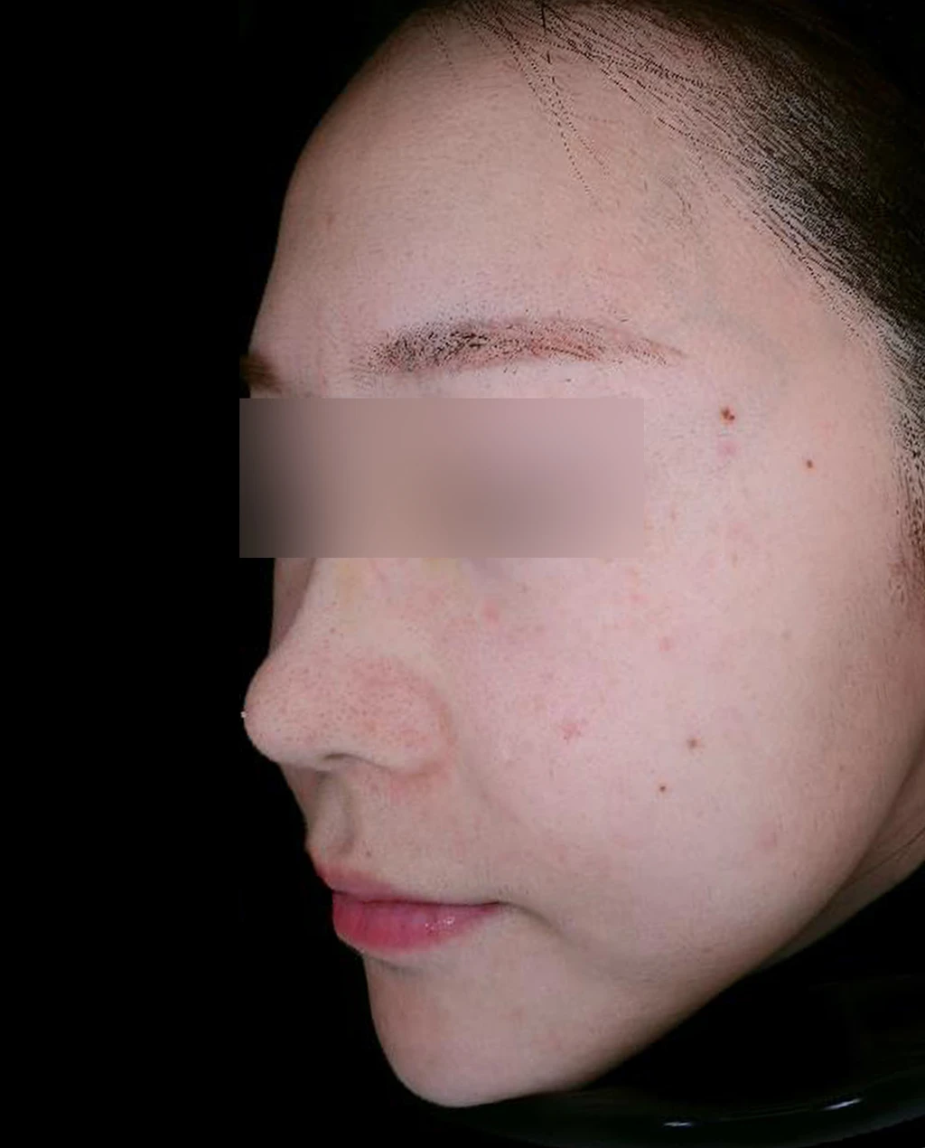 before_image