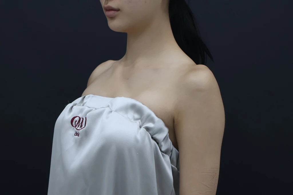 before_image