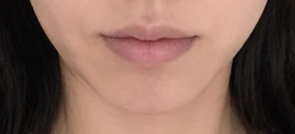 before_image