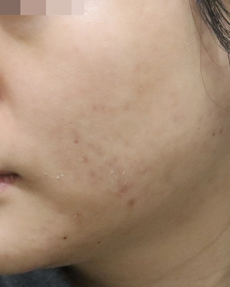 before_image