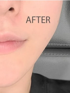 before_image