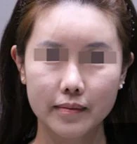 before_image