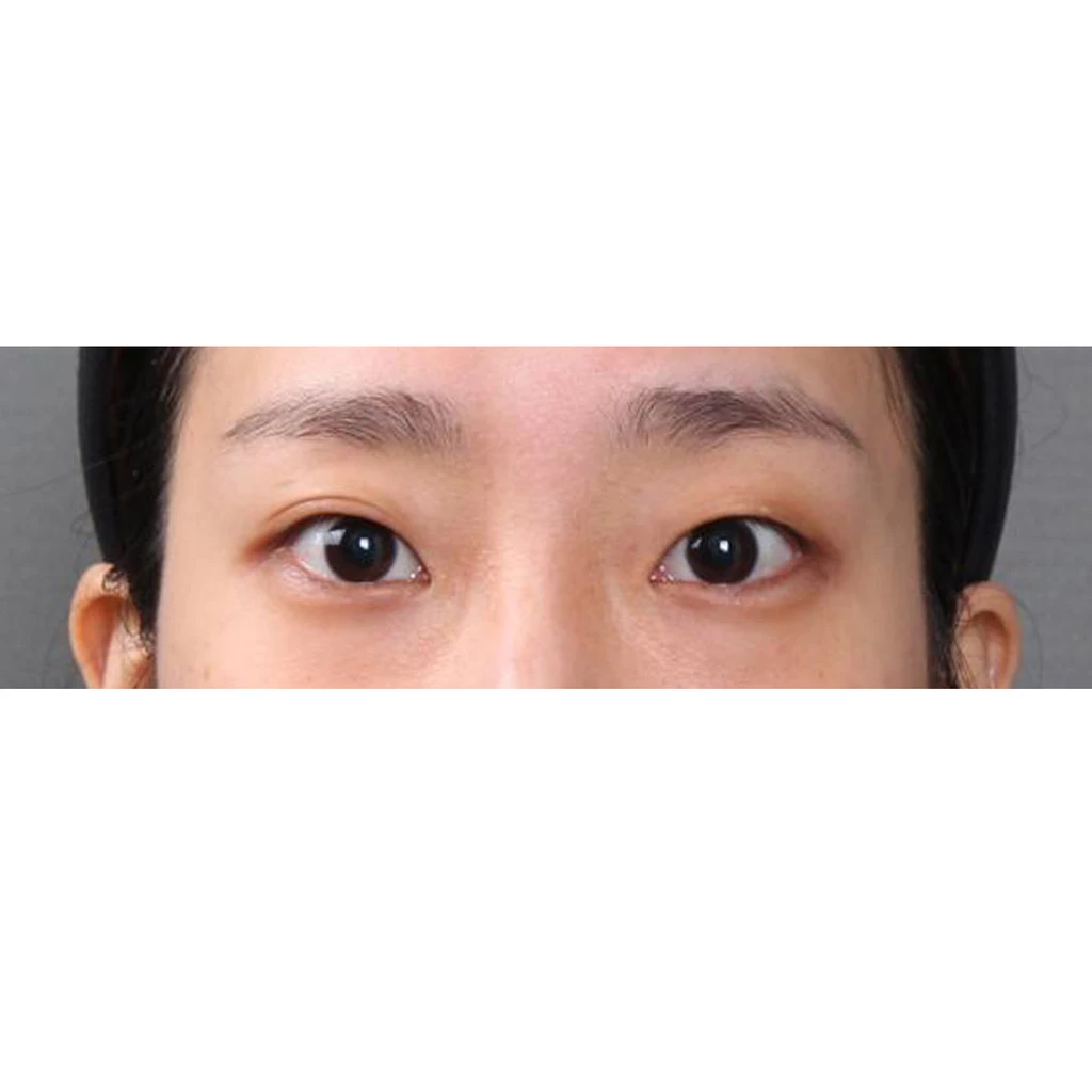 before_image