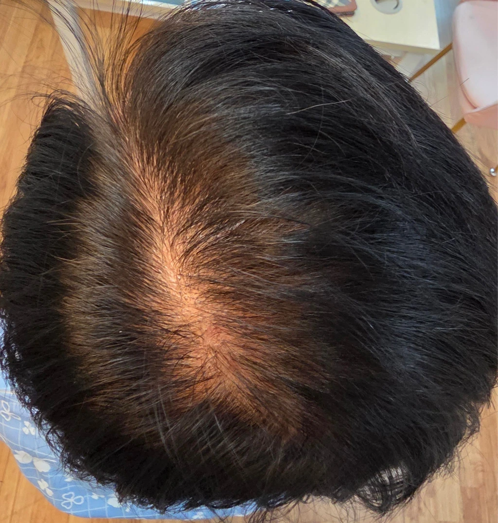 before_image