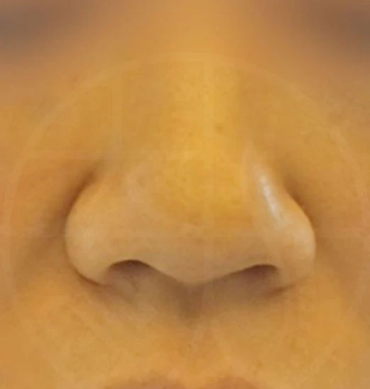 before_image