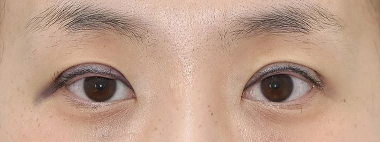 before_image