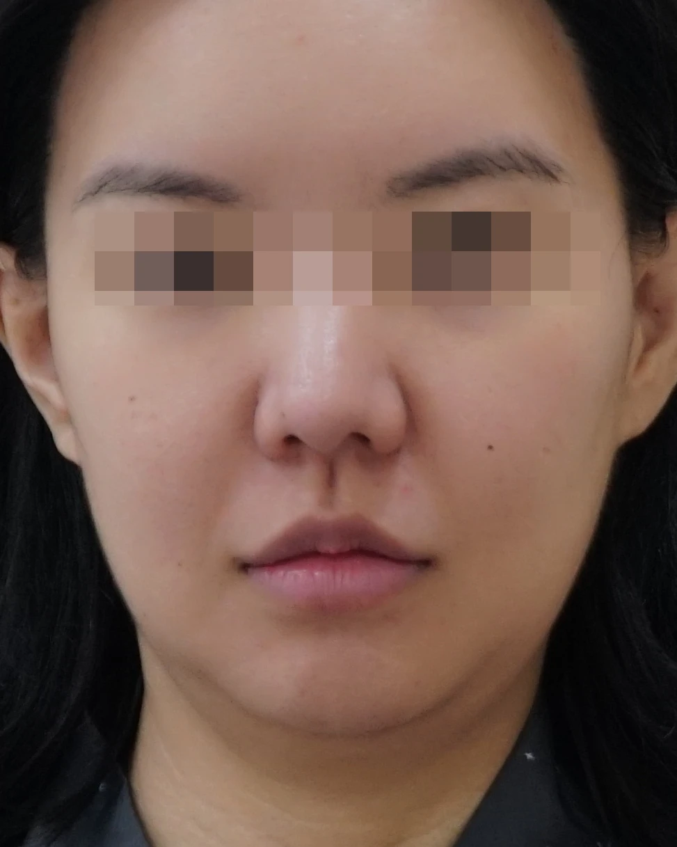before_image