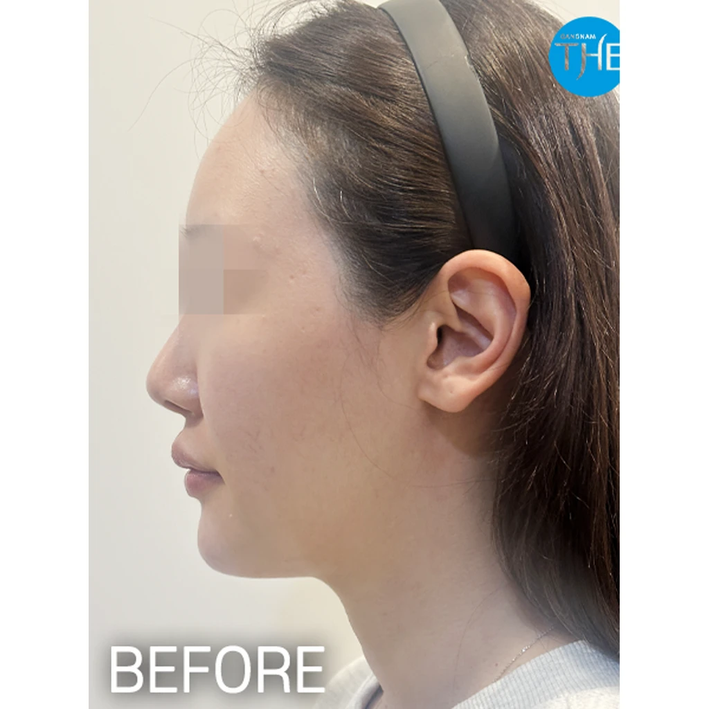 before_image