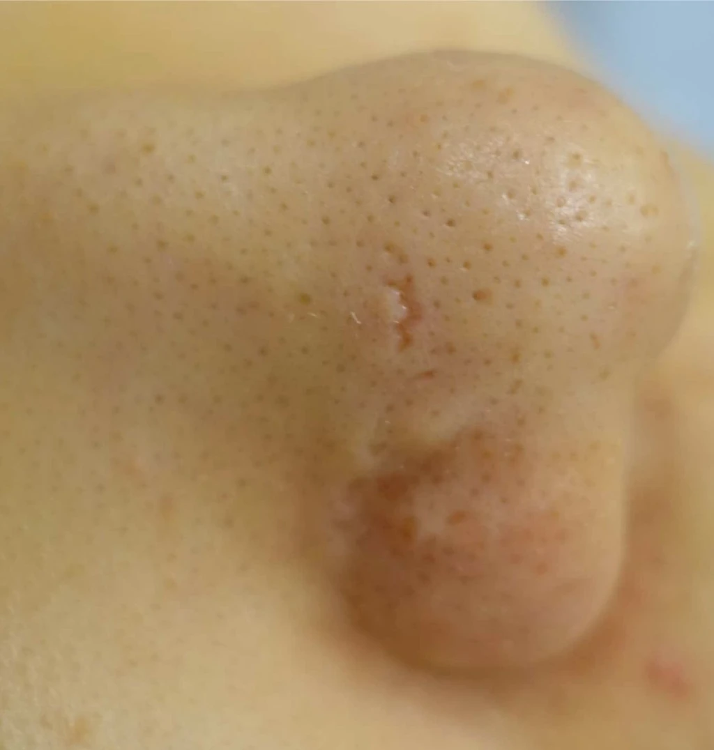 before_image