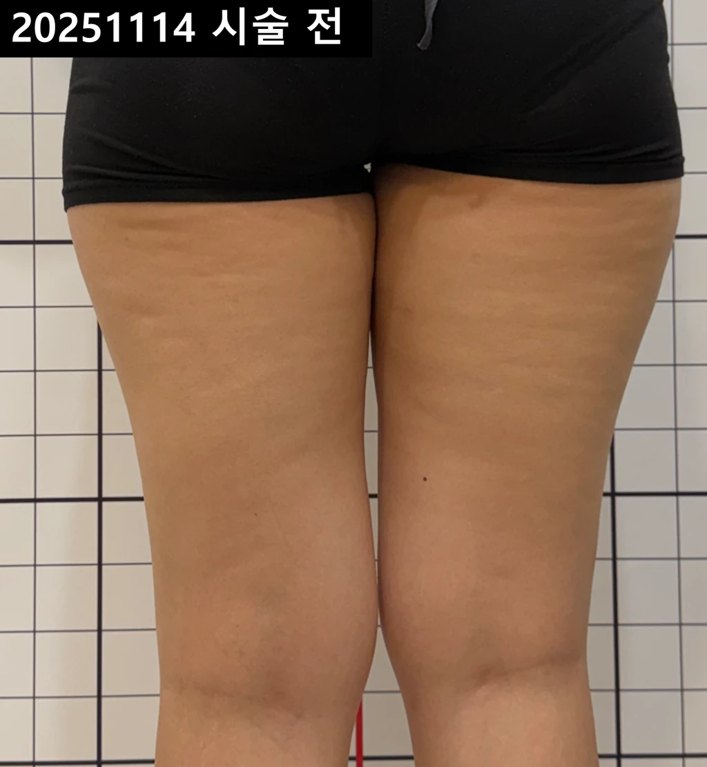 before_image