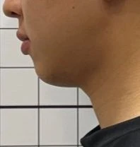 before_image