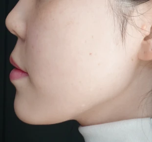 before_image