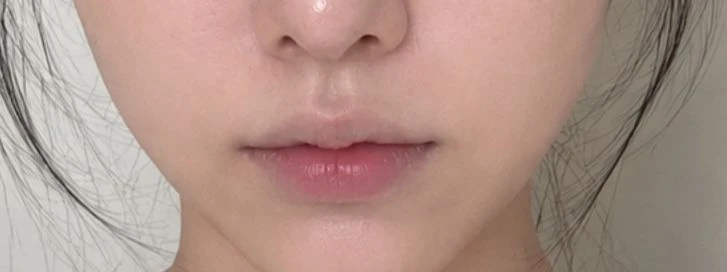 before_image