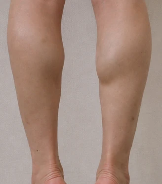 before_image