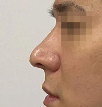 before_image