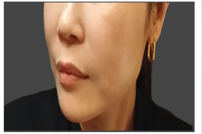 before_image