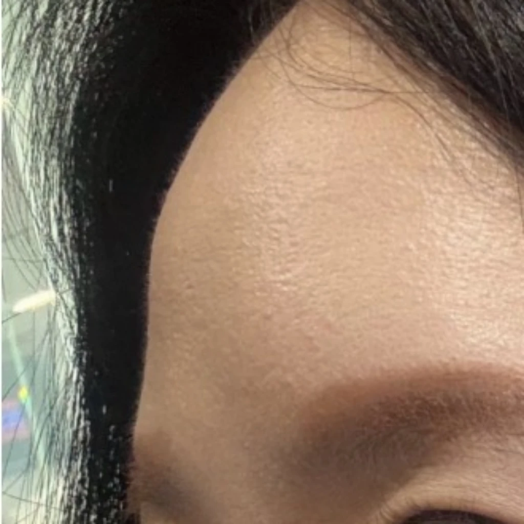 before_image