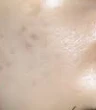 before_image