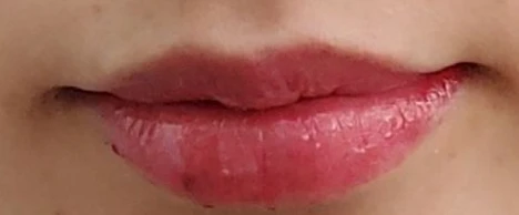before_image