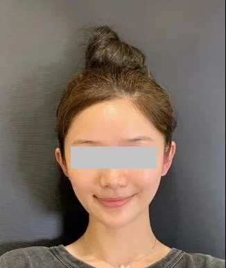 before_image